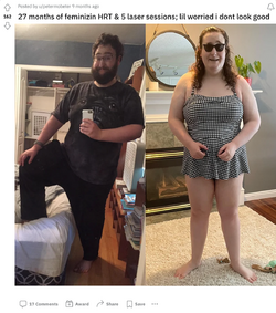 27-months-of-feminizin-HRT-5-laser-sessions-lil-worried-i-dont-look-good-transtimelines.png 27-months-of-feminizin-HRT-5-laser-sessions-lil-worried-i-dont-look-good-transtimelines.png