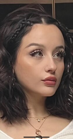 Lav lip filler.jpg Lav lip filler.jpg