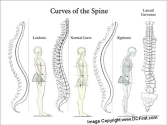 SpinalCurves18x24B__12436.1372618740-1527757593.jpg SpinalCurves18x24B__12436.1372618740-1527757593.jpg