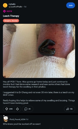 Screenshot_20251116_000420_com.reddit.frontpage_edit_883681032848491.jpg Screenshot_20251116_000420_com.reddit.frontpage_edit_883681032848491.jpg