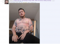 Screenshot_2019-11-09 ftm search results - flair SurgeryPic.png