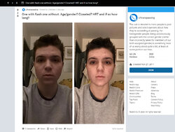 cystic_acne.jpg