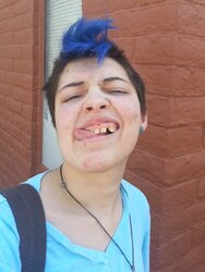 missingtooth1.jpg