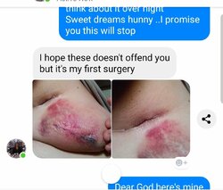 Norma's tumor bags.jpg