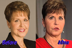 Joyce-Meyer-Plastic-Surgery-Before-and-After3.jpg