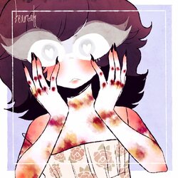 bloody_knuckles_and_bruises__oh_my__by_dollieguts_d7pcdcf-fullview.jpg