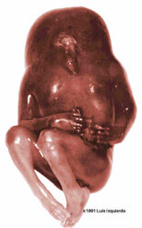 acardia2.jpg