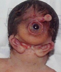 Cyclopia2.jpg