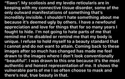 scoliosis22.jpg
