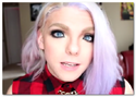 Waardenberg-Syndrome-photos.png
