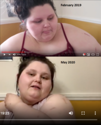 arm.png