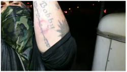 Regg's arm.PNG