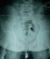 asiawire-cablepenis-01-1531230874.jpg