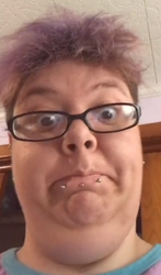spudisthesaddestdissease.png