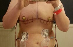 topsurgery.jpg