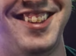 Digibro teeth 3.png