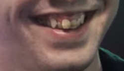 Digibro teeth 5.png