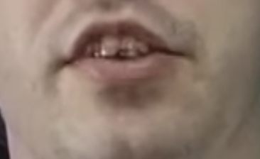 Digibro teeth 7.png