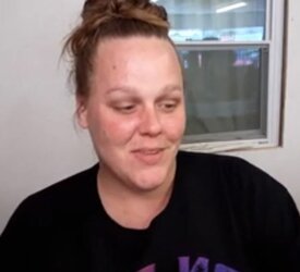 forehead.JPG
