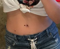 anisa mole belly 2.PNG