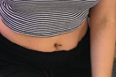 anisa mole belly.PNG