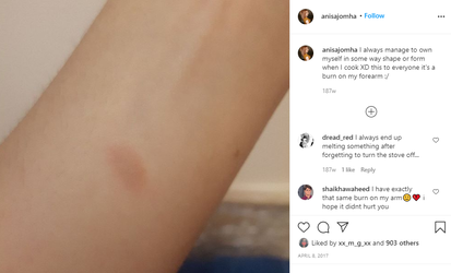 burn mark.png
