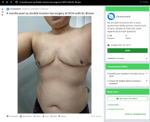 Hacked_off_tits.jpg