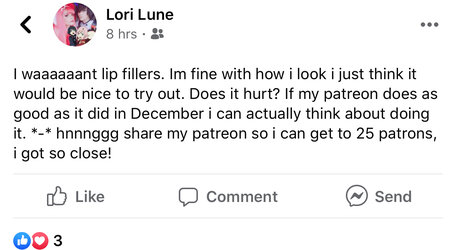 lipfillers 1580882100779.jpeg