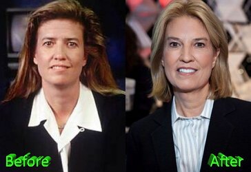proxy-image2.jpg