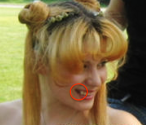 tooth1edit.png