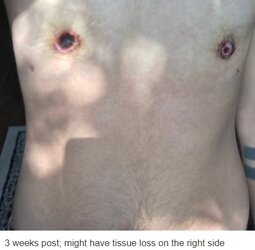 tits5a.jpg