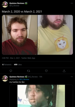 hairline.PNG