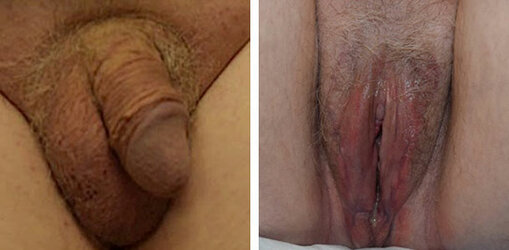 vaginoplasty-001.jpg