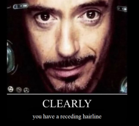 receding hairline.png