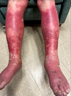 RASH2.jpg