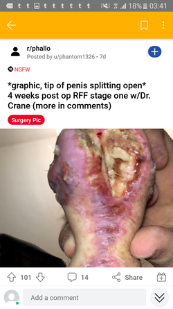 Screenshot_20210402-034148.png