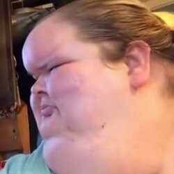 fat_forehead.jpg