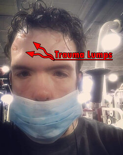 Russ Trauma.jpg