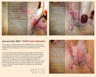 suture-reaction.jpg