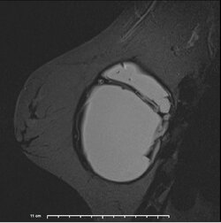 image-Patient_ 2].jpg