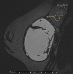 image-Patient_ 3].jpg