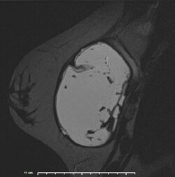 image-Patient_ 4].jpg