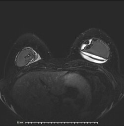 image-Patient_ 12].jpg