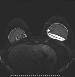 image-Patient_ 13].jpg