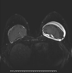image-Patient_ 14].jpg
