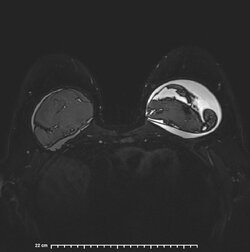 image-Patient_ 15].jpg