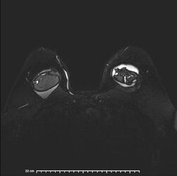 image-Patient_ 16].jpg
