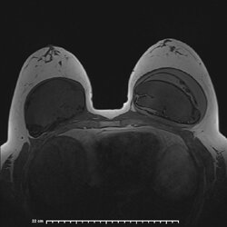 image-Patient_19.jpg