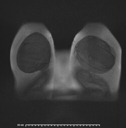image-Patient_30].jpg