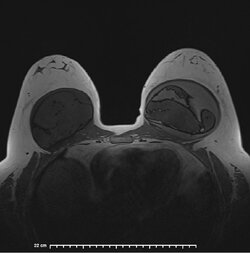 image-Patient_31].jpg